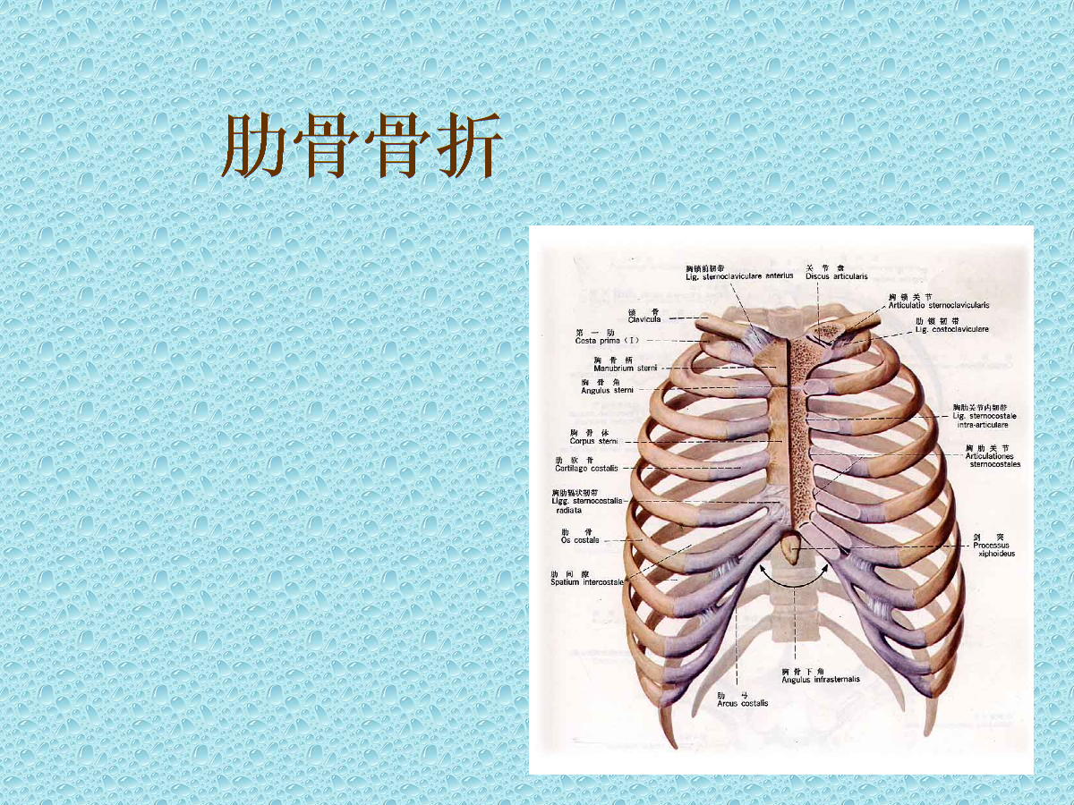 肋骨骨折评残标准